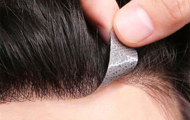 Best Hair Patches for men in Lucknow, Hair Patches service for men in Lucknow